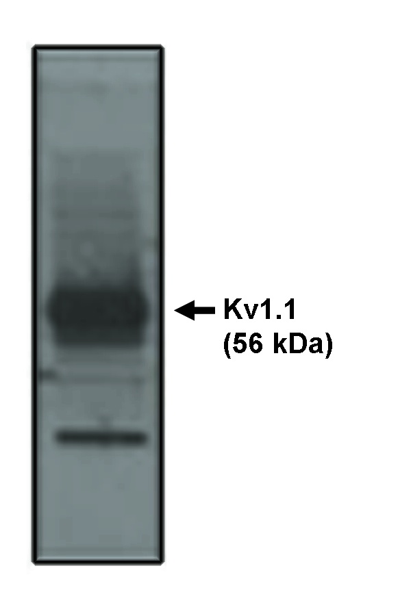 "
Western blot analysis
using Kv1.1 antibody on
rat brain lysate."